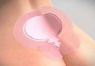 Allevyn Gentle Border Sacrum